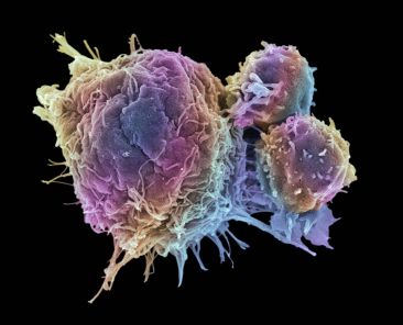 cancer_cell_and_T_lymphocytes-5a28416422fa3a0037111149