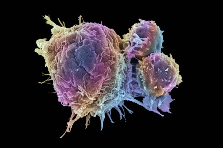 cancer_cell_and_T_lymphocytes-5a28416422fa3a0037111149